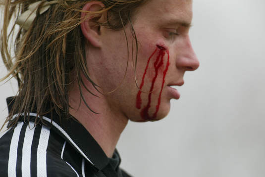 Fotboll, Fredrik "Hana" Andersson, IFK Hässleholm, har