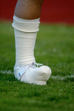 Skada, skadad fot, gips, ben, gymnastiksko
