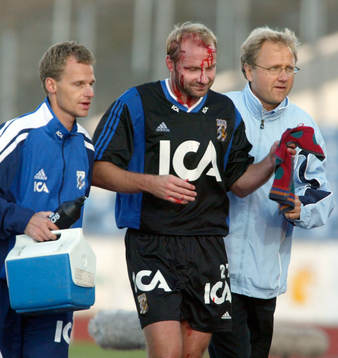 Både Håkan Mild och IFK Göteborg sargades. Skada, blod