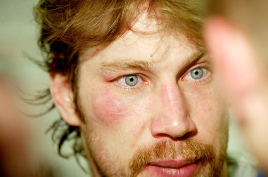 Peter Forsberg, Sverige fick en smäll i ansiktet…