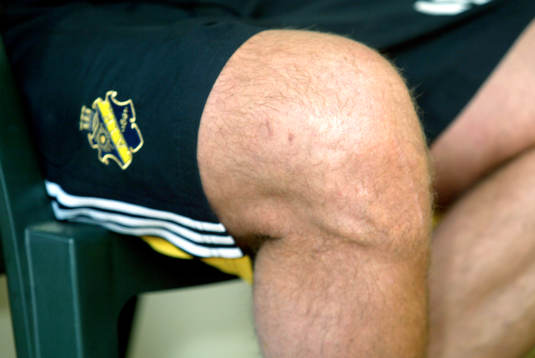 Andreas Anderssons skadade knä (Andreas Andersson, AIK)