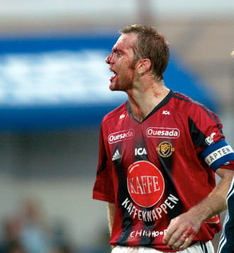 Markus Karlsson, Djurgården. Blod, skada,  skadad