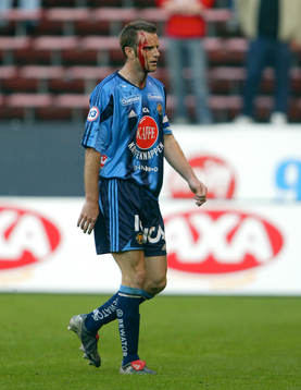 Markus Karlsson, Djurgården. Skada, blod