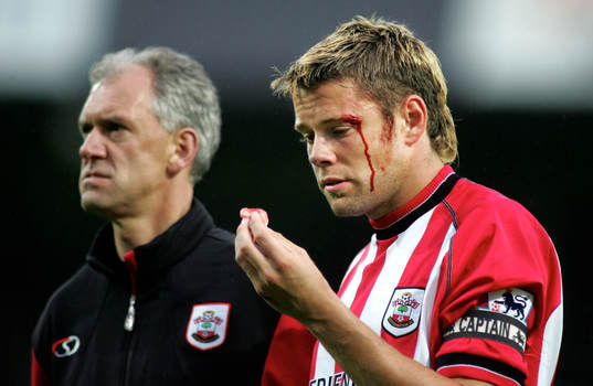 James Beattie, Southampton. Skada, blod