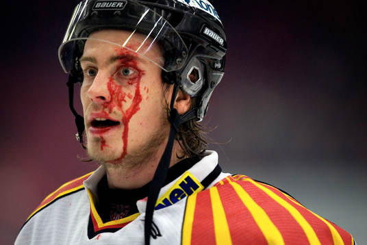 Mikko Kuparinen, tappade ett ögonbryn. Skada, blod