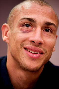 Henrik Larsson med blåöga