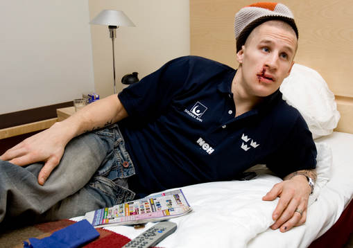 Jonathan Hedström Timrå IK, Tandskada, Skada