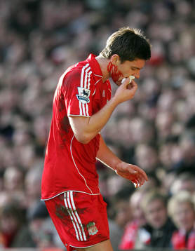 Steven Gerrard, Liverpool (Skada, Blod)