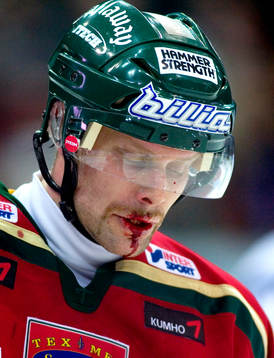 Oscar Ackeström, Frölunda, skadad, blod, utslagen tand,