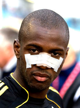 Dulee Johnson, AIK, med näsplåster, plåster