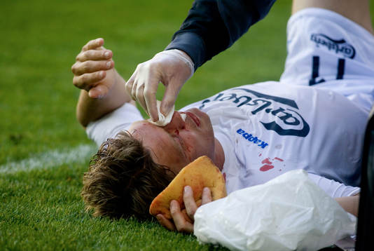 Marcus Allbäck, Köpenhamn, fick en rejäl smäll på