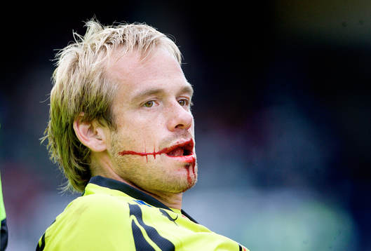 Peter Westman, Målvakt Örebro fick bäras av från planen