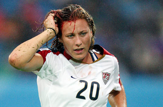 Abby Wambach, USA. Skada, blod