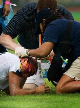 Abby Wambach, blod, läkare plåstrar om henne. Skada