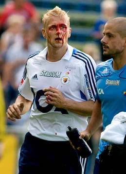 Toni Kuivasto, Djurgården, blodig