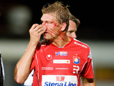 Marcus Allbäck skadar näsan i en nickduell och får utgå
