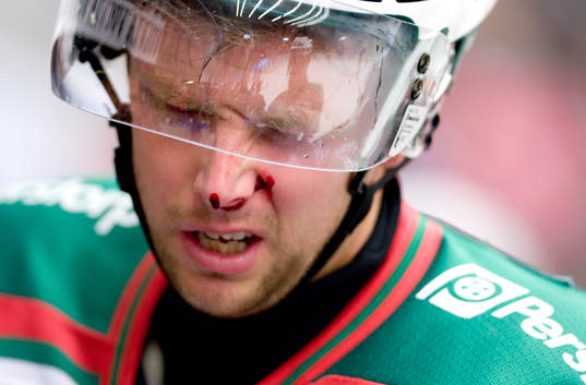 Jakob Johansson, Rögle blir skadad. Skada, blod