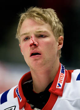 Jesper Samuelsson, tacklas blodig. Blod, skada