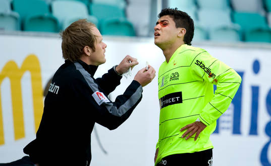 Paulinho, Häcken, blöder från ögonbrynet, blod, sår,