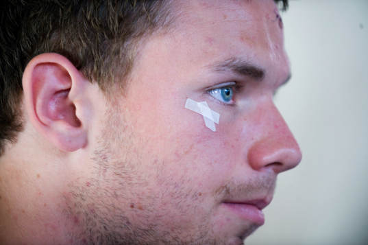 Marcus Berg dagen efter