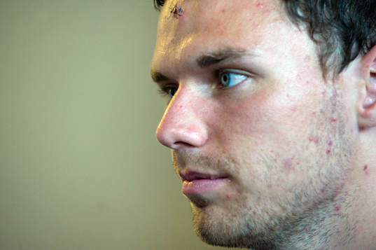 Marcus Berg