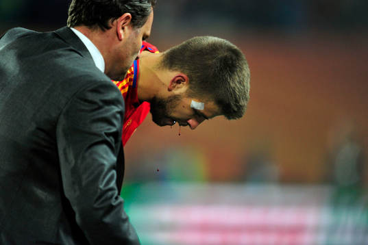 Gerard Pique, Spanien, skada, blod