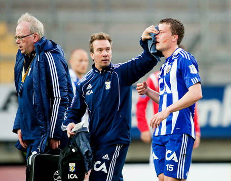 Jakob Johansson, IFK Göteborg, skadar näsan