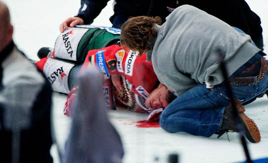 Magnus Kahnberg, Frölunda, skada, blod