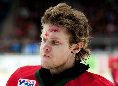 Anton Axelsson, Frölunda, får en smäll i pannan. Skada,