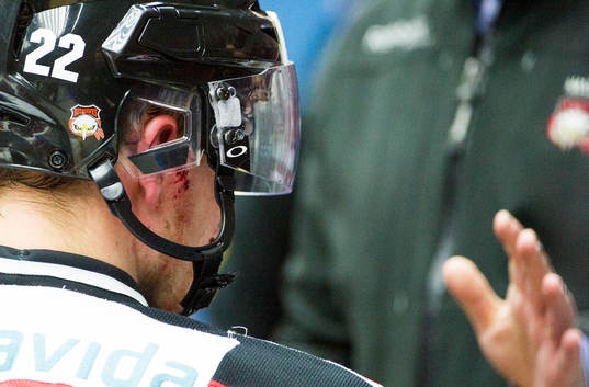 Alexander Bergström, Malmö Redhawks, träffades av