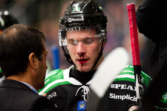 Alexander BArta, Rögle, skada, blöder