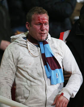 Football - West Ham United v Tottenham Hotspur - Barclays