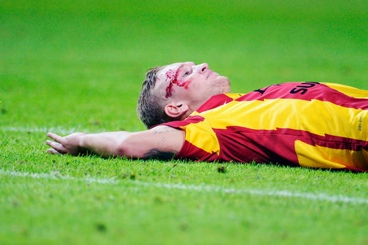 Alexander Michel, Syrianska blöder ymnigt