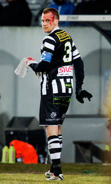 Linus Malmqvist, Landskrona, blöder blod