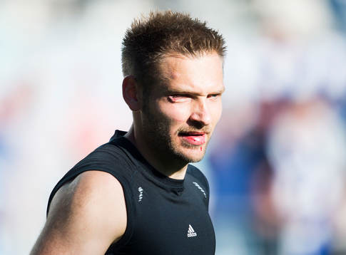 IFK Göteborgs målvakt John Alvbåge fick sy några stygn