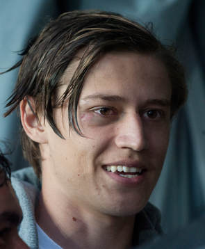 Simon Thern, Malmö, med sitt blåa öga, i
