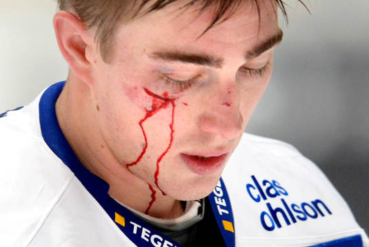 Leksands Tobias Forsberg får ett rejält sår