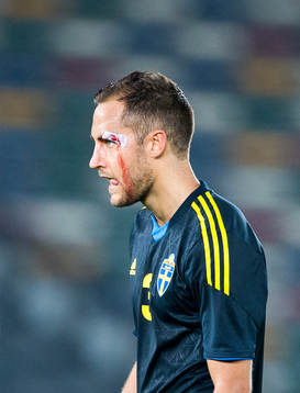 Sveriges Niklas Backman med blödande ögonbryn