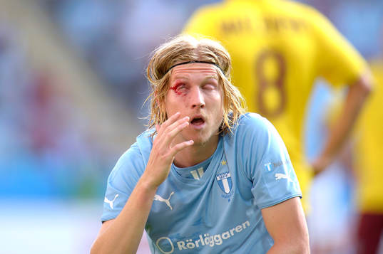 Malmö FFs Simon Kroon blöder från ögonlocket