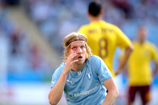 Malmö FFs Simon Kroon blöder från ögonlocket