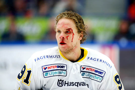 s Andreas Jämtin blöder