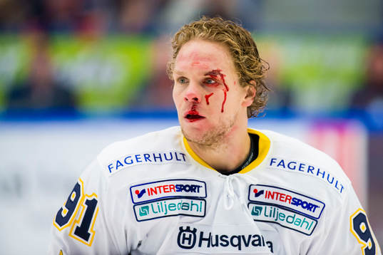 s Andreas Jämtin blöder
