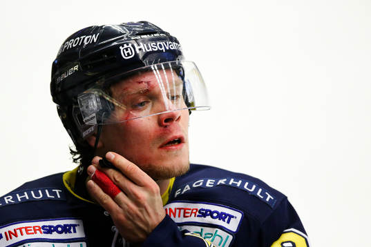 s Andreas Jämtin blodig i ansiktet
