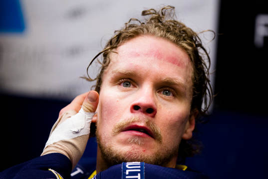 s Andreas Jämtin med bandage om tummen