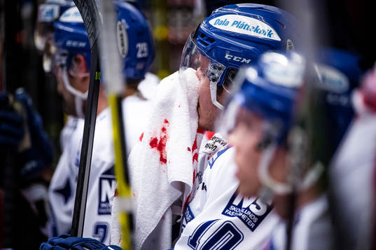 Leksands Brian Connelly blöder näsblod nder