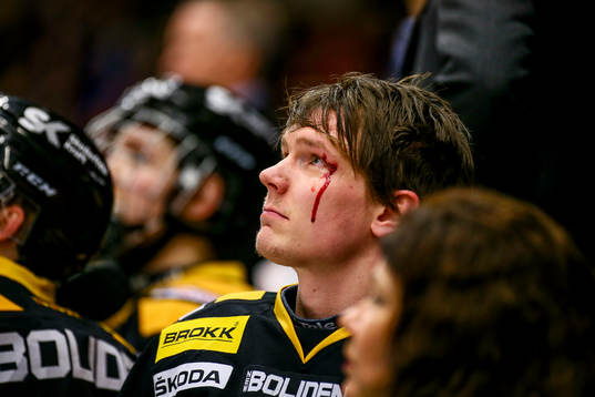 Skellefteås Patrik Zackrisson blodig