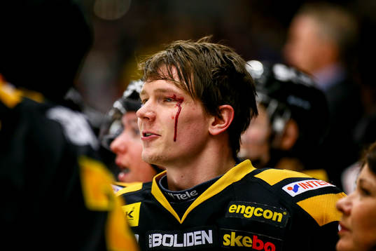 Skellefteås Patrik Zackrisson  blodig