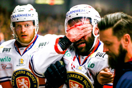 Växjös Josh Hennessy fick en puck i ansiktet och blödde