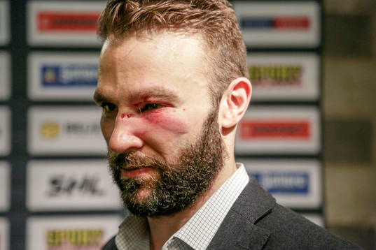 Växjös Josh Hennessy med svullet öga
