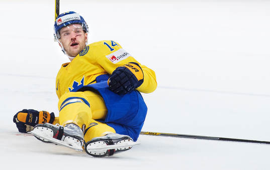Sveriges Mattias Ekholm blöder ymnigt i ansiktet